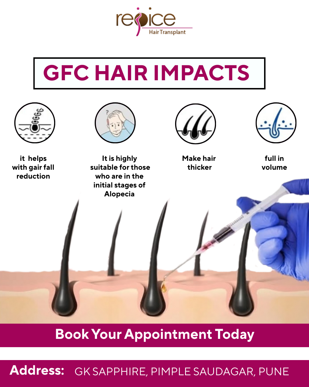 Why More People Are Choosing the Best Hair Transplant Clinic in Pune for Natural Results