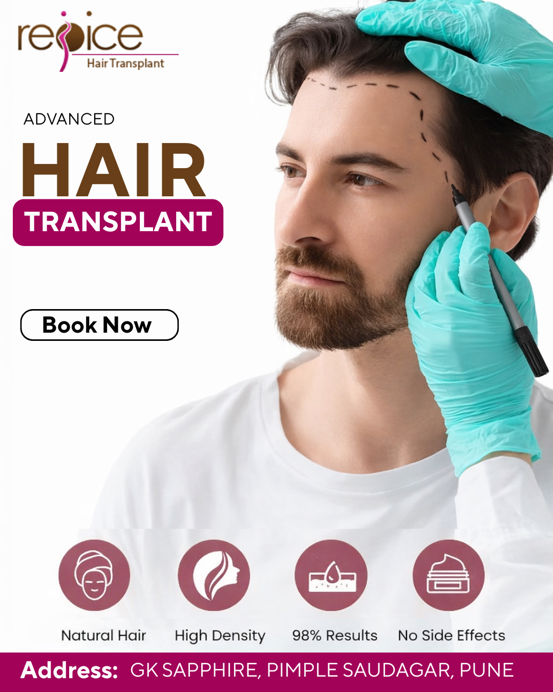 Noticing a Receding Hairline? Explore Advanced FUE Hair Transplant in Pune